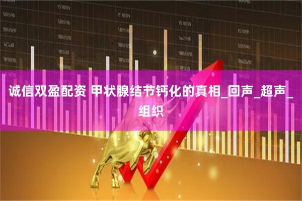 诚信双盈配资 甲状腺结节钙化的真相_回声_超声_组织